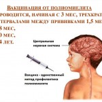 Полиомиелит1
